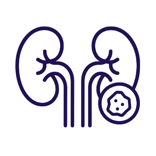 Kidney Stone Treatment​